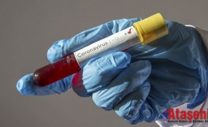 Kuzey Kıbrıs'ta bir aydır koronavirüs vakası görülmedi