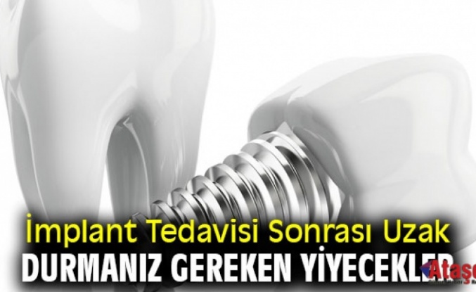 İmplant Tedavisi Sonrası Uzak Durmanız Gereken Yiyecekler