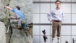 Biyonik Bacak Teknolojisinde Gelinen Son Nokta, New bionics let us run, climb and dance | Hugh Herr