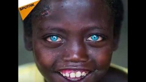 Evrenin bir mucizesi: Mavi gözlü Afrikalılar